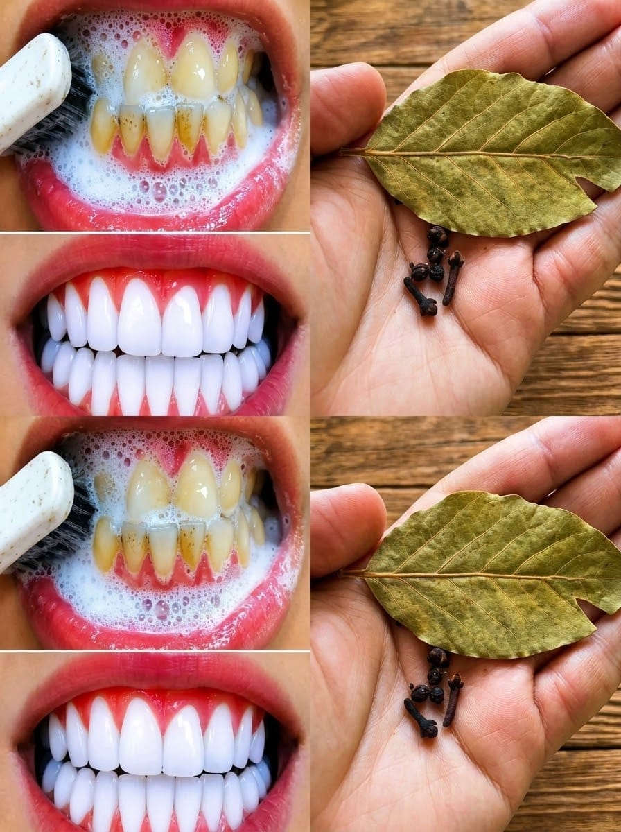 Whiten Your Teeth and Reduce Plaque Buildup with Cloves and Bay Leaves